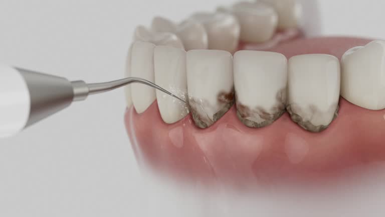 Reliable Dental contractor in San Anselmo, CA by Dentist Open Now